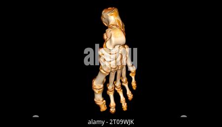 Foot 3D Scan for diagnosis foot diseases by CT-SCANNER . Stock Photo