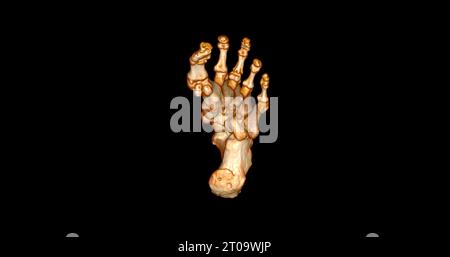 Foot 3D Scan for diagnosis foot diseases by CT-SCANNER . Stock Photo