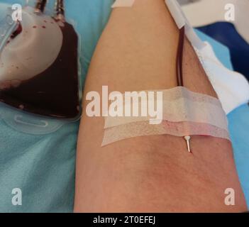 Arm of Man on hospital bed with needle stuck in forearm during medical operation Stock Photo