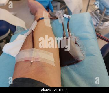 Man with needle stuck in forearm during medical operation Stock Photo