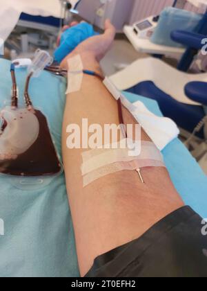 Arm of Man on hospital bed with needle stuck in forearm during medical operation Stock Photo