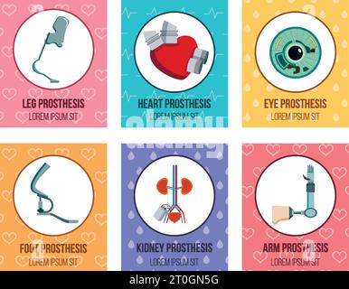 Orthopedic medical prothesis flat cards collection with artificial kidney eye implants and prosthetic limbs isolated vector illustration Stock Vector