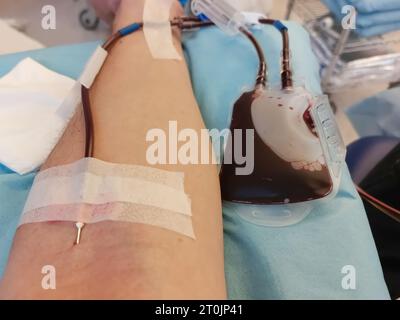 Arm of Man on hospital bed with needle stuck in forearm during medical operation Stock Photo