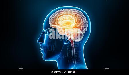 Human brain neural activity or inflammation x-ray 3D rendering illustration with body. Anatomy, neurological disease, headache, intelligence, medical, Stock Photo