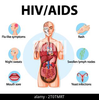 Illustrated infographic depicting the impact of HIV/AIDS on the body's immune system Stock Vector