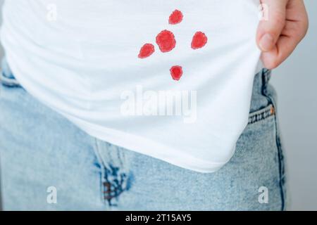 dirty blood stain on clothes. The concept of cleaning stains on clothes.  Isolated on a blue background Stock Photo - Alamy