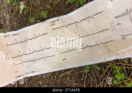 Abandoned ECG tracing on the ground, a poignant symbol of forgotten medical history. Stock Photo