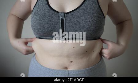 Close-up of fat folds on the large belly of an overweight woman. Concept of overweight, female obesity, dieting and overweight problems Stock Photo