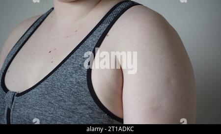 Light-skinned young woman with drooping arms. Sad bad body shape girl ...