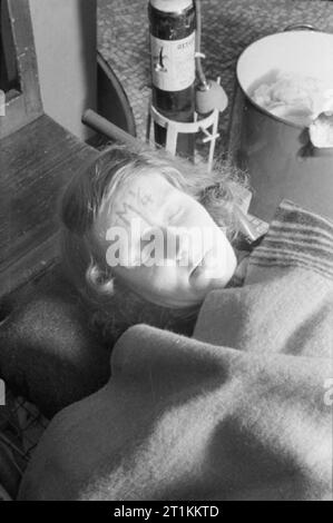 Guy's Hospital- Life in a London Hospital, England, 1941 This patient has been marked on the forehead with 'M 1/4' meaning that they have received a 1/4 grain of morphine before arrival at the hospital. Stock Photo