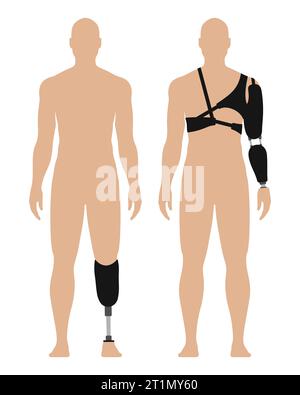 Man with prosthetic arm and leg, medical vector illustration set, isolated on white background. Stock Vector