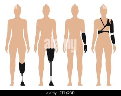 Woman with prosthetic arm and leg, medical vector illustration set, isolated on white background. Stock Vector