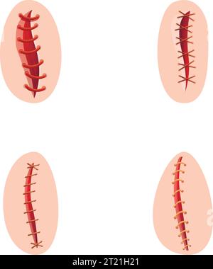 Surgical suture icons set cartoon vector. Various type of operating suture. Surgery, healthcare concept Stock Vector