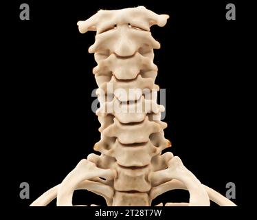 CT scan of C-Spine or Cervical spine 3D rendering  for diagnosis  fracture of cervical spine in  trauma case. Stock Photo