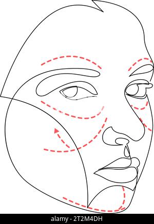 Continuous one line drawing of beautiful woman with marks drawn on her face for plastic cosmetic surgery. Single line abstract female face vector illu Stock Vector