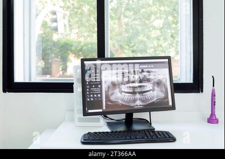 Teeth X-ray on computer at desk in clinic Stock Photo