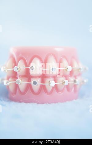 Metal orthodontic denture base. No people Stock Photo