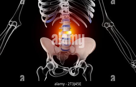 Anatomy of Human Spine. Lower back pain and human backache Stock Photo ...