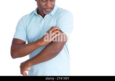 Man scratching his arm Stock Photo