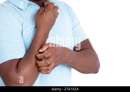 Man scratching his arm Stock Photo