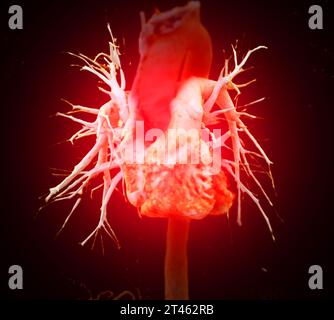 CTA pulmonary artery  or CTPA with contrast media 3D rendering  normal pulmonary artery. Stock Photo