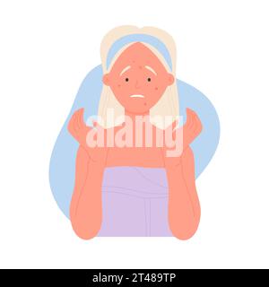 Upset girl with facial acne. Problematic face skin, blackheads and pimples cartoon vector illustration Stock Vector