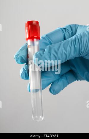 a medical specialist's hand in a sterile glove holds a clean red blood test tube Stock Photo