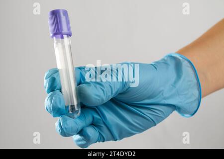 a medical expert's hand in a sterile glove holds a clean blue blood test tube Stock Photo