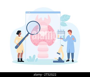 Diagnosis of thyroid disease vector illustration. Cartoon tiny doctors with magnifying glass and test tube with medical samples analyze infographic poster with thyroid gland, endocrine system organ Stock Vector