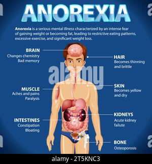 Illustration depicting the impact of Anorexia on various body functions ...