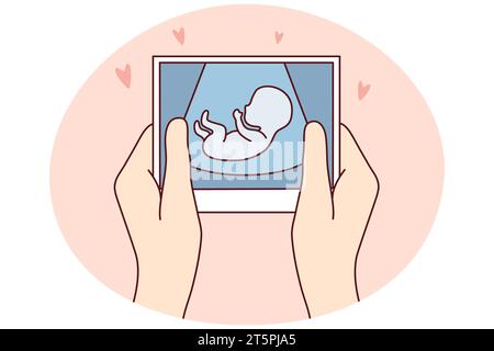 Hands of person holding scan of embryo waiting for baby birth. Future mother with ultrasound picture of baby. Motherhood concept. Vector illustration. Stock Vector