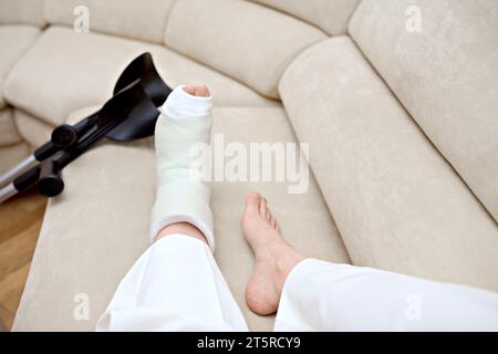 Young woman, with a fractured bone in her foot, is resting on the sofa.  Broken leg healing time.  Rehabilitation after serious physical accident Stock Photo