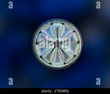 Actinoptychus heliopelta, centric diatom Stock Photo