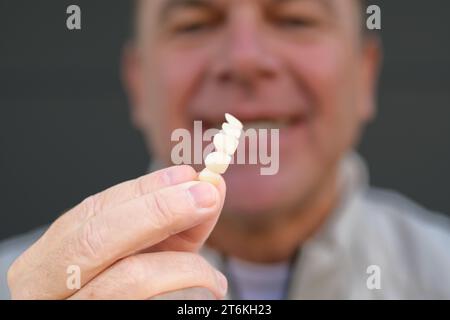 Extreme close up of a man holding his Dental prosthesis with his fingers, focus on hand Stock Photo
