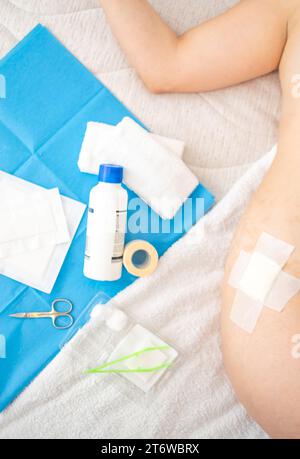View of Body lying wounded with gauze on hip and Aid Kit utensils Background Stock Photo