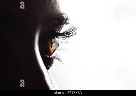 Macro of a brown woman eye suffering from keratoconus. A cone-shaped deformation of the cornea isolated on white background Stock Photo