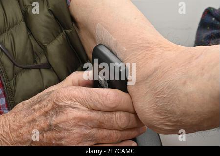 Patient reading a continuous glucose monitor Stock Photo