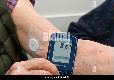 Patient reading a continuous glucose monitor Stock Photo