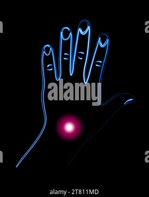 Vector isolated illustration of wrist pain. Hand with localization of pain in the wrist. Stock Vector