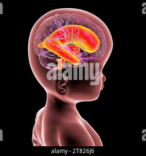 Baby with enlarged brain ventricles, illustration Stock Photo