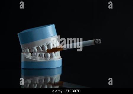 Plaster model of the jaw with a cigarette on a black background. Smoking harms your teeth. Stock Photo
