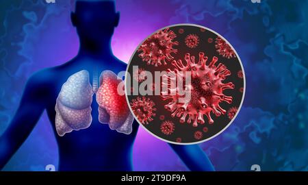 Pneumonia Outbreak Virus pathogen Lung Infection and Human lung infections or respiratory inflammation disease as influenza flu outbreak or pulmonary Stock Photo