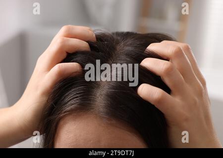 Woman examining her hair and scalp on blurred background, closeup Stock Photo