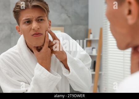 Upset young man looking at mirror and popping pimple on his face indoors. Acne problem Stock Photo