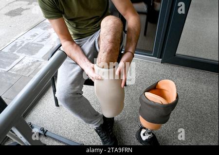 Non Exclusive: ZAPORIZHZHIA, UKRAINE - NOVEMBER 17, 2023 - A prosthetic leg of serviceman Andrii is being fitted at the Prosthetics and Rehabilitation Stock Photo