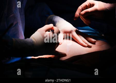 PRODUCTION - 29 November 2023, Schleswig-Holstein, Rendsburg: Two doctors perform an abdominal operation in the Schön Klinik's surgery center. Photo: Frank Molter/dpa Stock Photo
