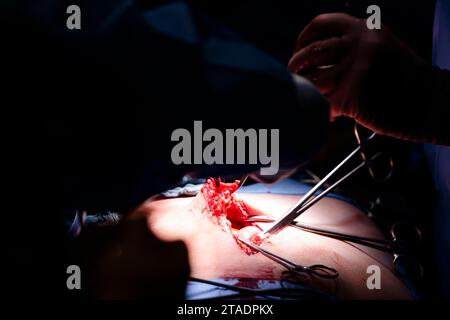 Rendsburg, Germany. 29th Nov, 2023. Two doctors perform an abdominal operation in the Schön Klinik's surgery center. Credit: Frank Molter/dpa/Ģ����ý Live News Stock Photo