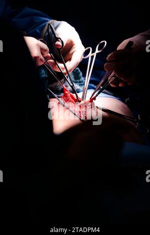 Rendsburg, Germany. 29th Nov, 2023. Two doctors perform an abdominal operation in the Schön Klinik's surgery center. Credit: Frank Molter/dpa/Ģ����ý Live News Stock Photo