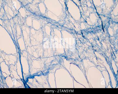 Areolar connective tissue, light micrograph Stock Photo