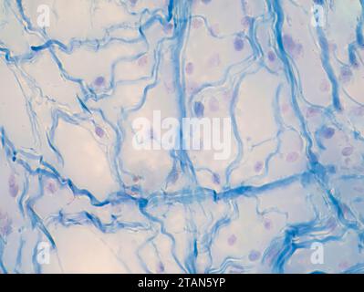 Areolar connective tissue, light micrograph Stock Photo